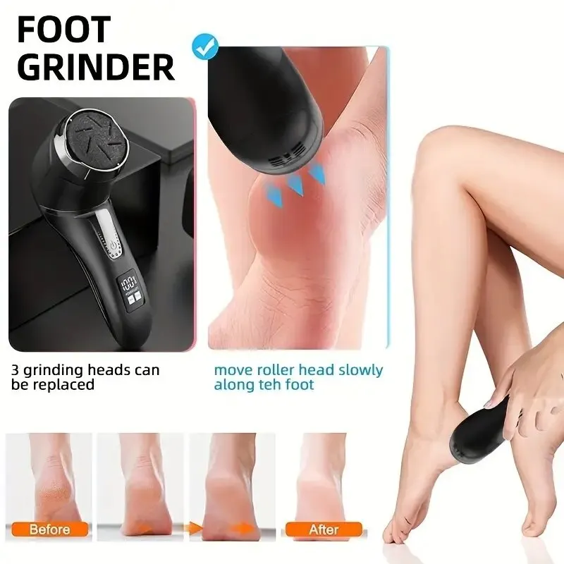 https://ae01.alicdn.com/kf/S095ed5778a17469eacc8b67bd8ae19ach/Professional-Electric-Callus-Remover-For-Feet-Rechargeable-Foot-Care-Kit-With-3-Heads-Dander-Vacuum-Cleaner.jpg