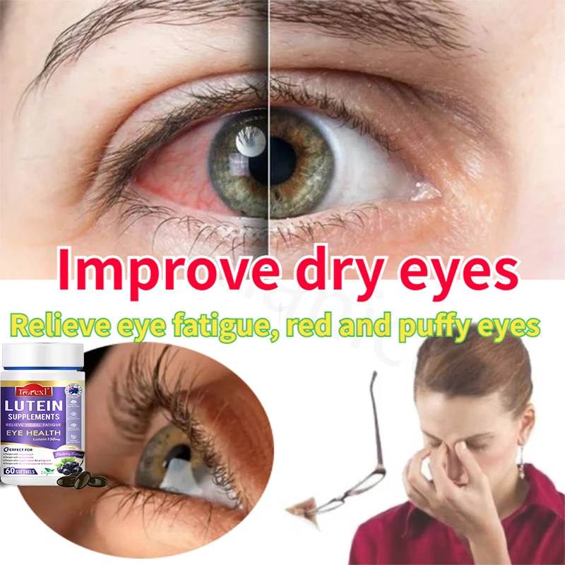 Trorexl Restore Vision Lutein Extract Supplement for Eye Strain Relieve Eye Fatigue Red & Dry