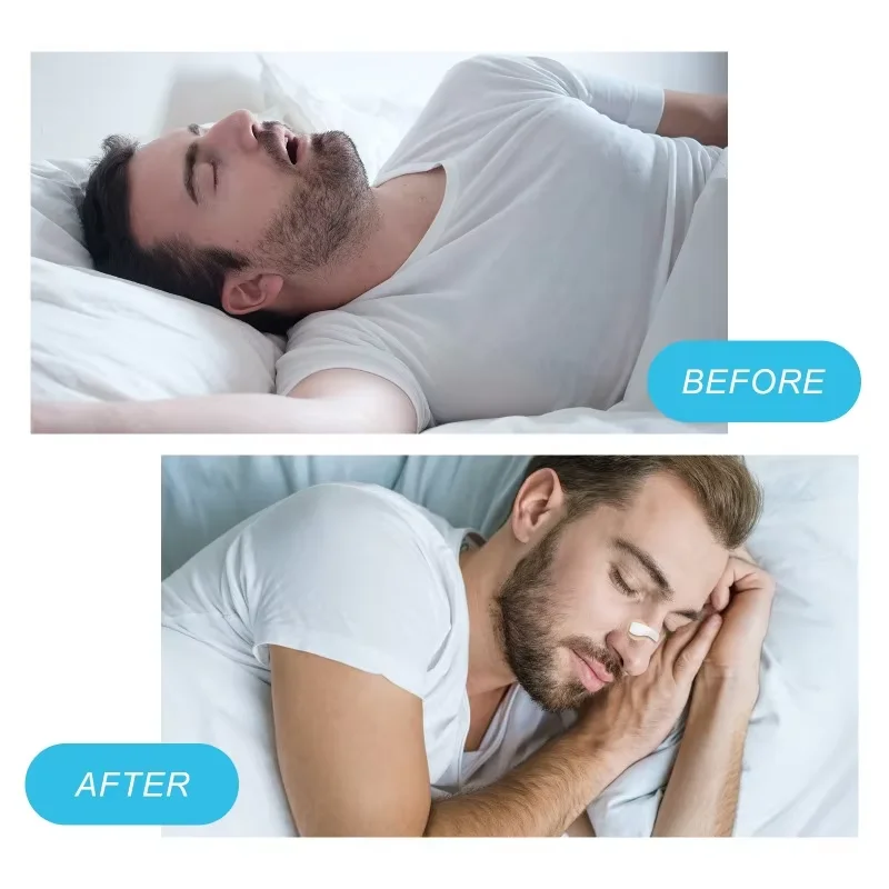 Magnetic Nasal Strips for Breathing Anti-snoring,nasal breathing dilator,nasal strips,nose strips,snoring nose strips,nasal patch,anti snoring patch,stop snoring