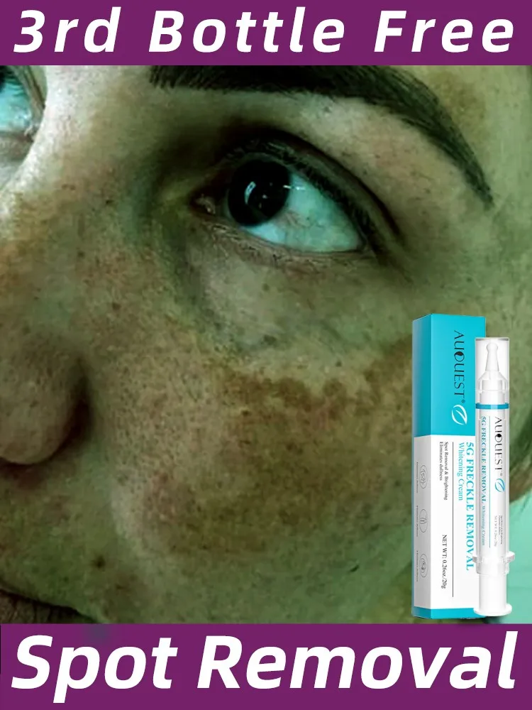 High Quality Face Cream for Dark Spots Whitening Moisturize Lighten Remove Pigment Fade Melanin Freckles Facial Skin Care Beauty