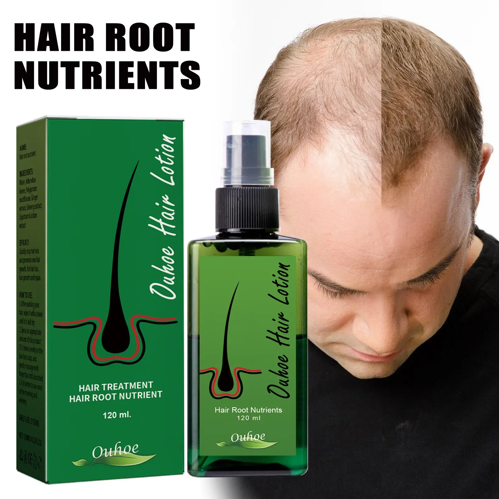 

Natural Thailand Neo Hair Lotion Hair Care Oil Hair Grow Serum Essential Hair Loss Treatment Product Hair Growth