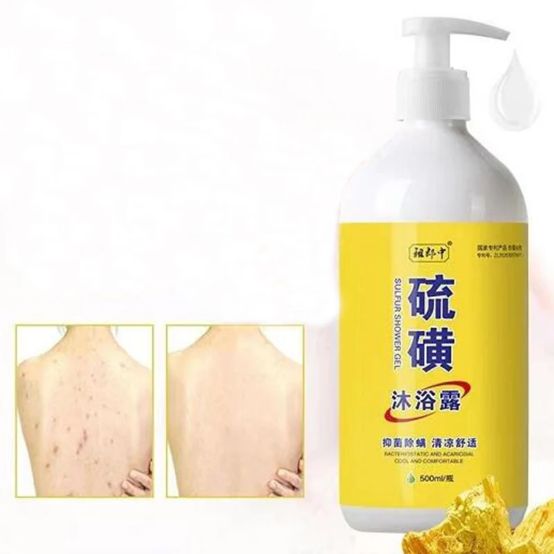 Effective Sulfur Ointment Scabies Mites Fat Bath Body Cream Sulphur Body Wash Lotion for Itching and Sterilization Whitening Body Lotion Body Wash
