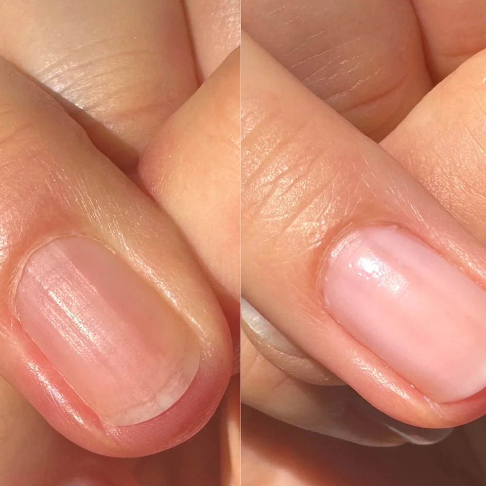 Tinovo Uno Ridge Filler Smooth Base Coat Keratin Nail Strengthener Imperfections Concealer 12ML Manicure Repair Damaged Nails