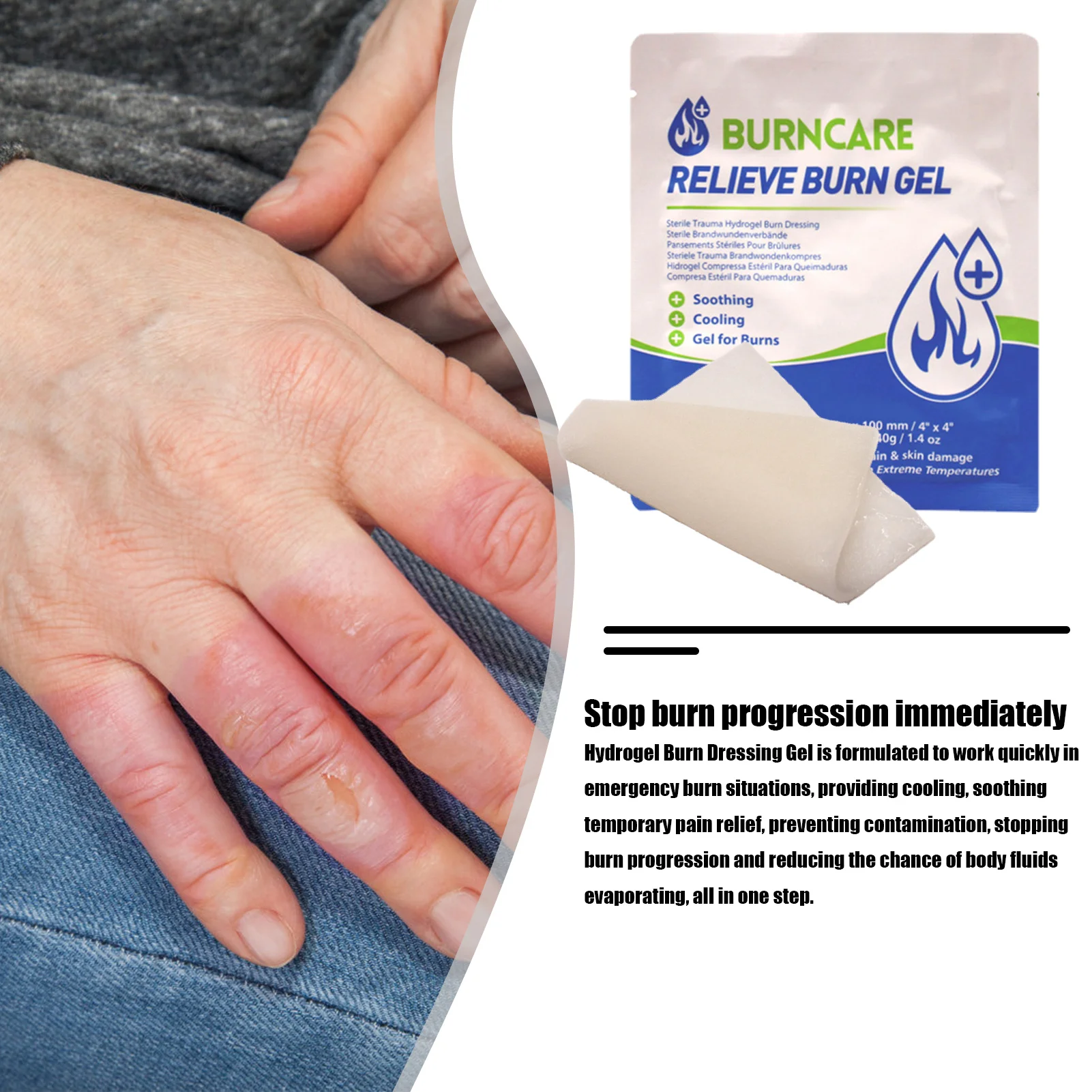 Burn Dressing Emergency Burn Care Gel Cooling And Soothing Hydrogel Wound Dressing Water Gel For Debridement First Aid first aid kit wound bandage medical wound dressing