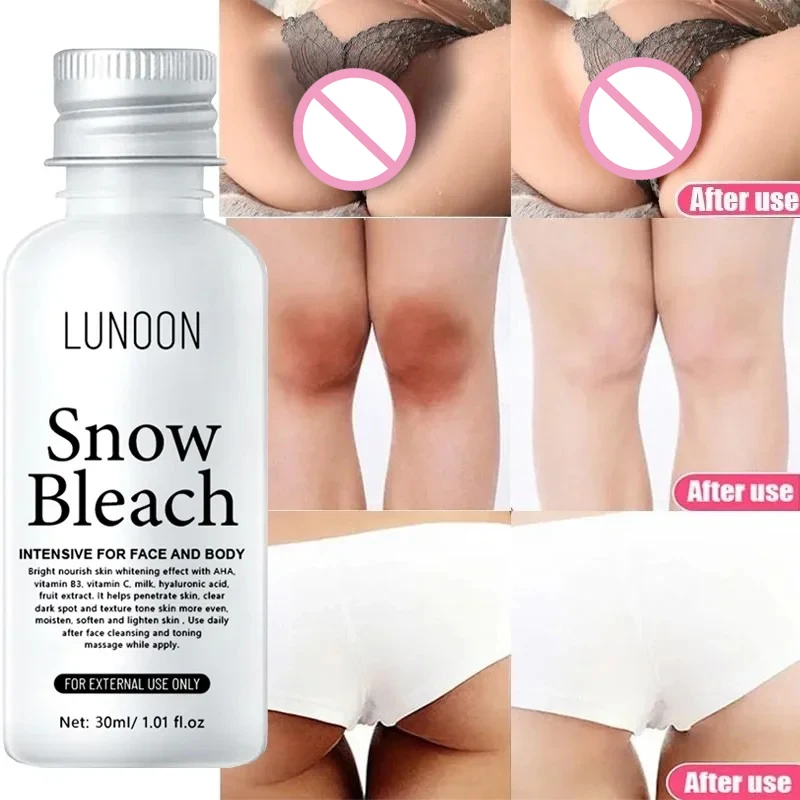 

Effective Body Whitening Cream Private Parts Bikini Underarm Bleaching Lighten Melanin Inhibitor Brighten Body Korean Skin Care