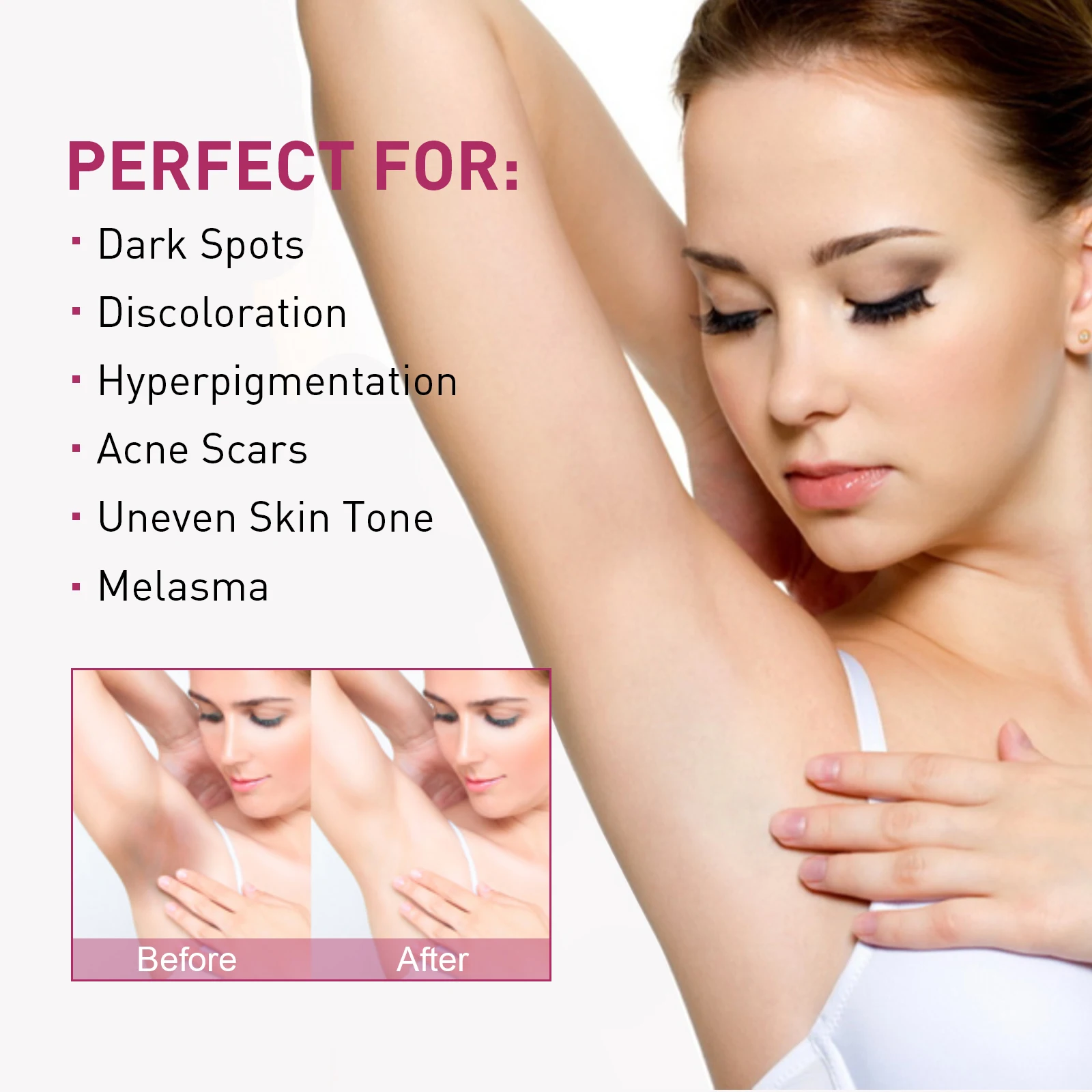 Whitening Cream For Dark Skin Underarm Armpit Thigh Inner Joint Lightening Sensitive Area Body Care Moisturizing Brighten Lotion 2