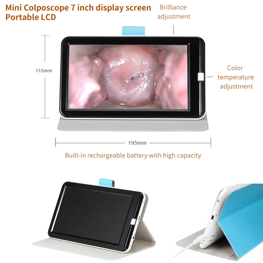 Mini Colposcope with Digital Video for Accurate Link PC Monitoring Health Monitors Accesorios Medicos Selectable Add Pad