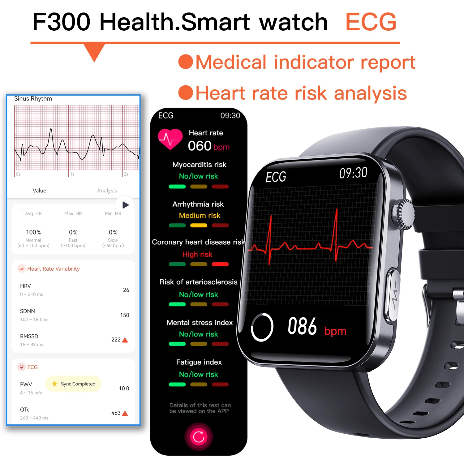 Smart watch blood glucose monitor blood test meter smart blood sugar watch 24h measurement of glucose blood pressure lipids uric acid ECG wireless Bluetooth smart APP
