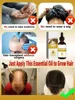Transform Your Thin Hair into a Voluminous Mane 5