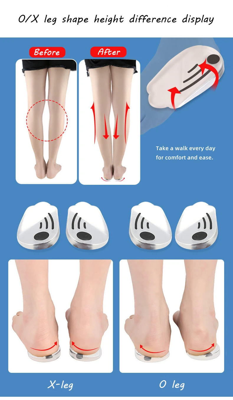 Magnet Silicone Massage Insoles Gel O/X Type Leg Orthopedic Heel Pads Corrector Valgus Varus Foot Shoe Insole Insert Feet Care