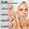 5ML/15ML/30ML/50ML/Face Essence Essential Oils Vitamin E Skin Oil 100% Nature Face Serum Anti-Wrinkle Moisturizing Tight Whiteni 5