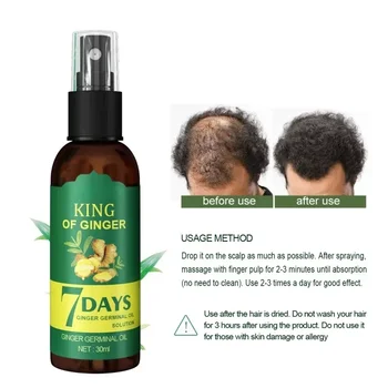 Spray per la crescita dei capelli allo zenzero Massaggio rinforzante per il cuoio capelluto Rinforzamento dei capelli denso Prevenzione della caduta dei capelli Riparazione Liquido nutriente