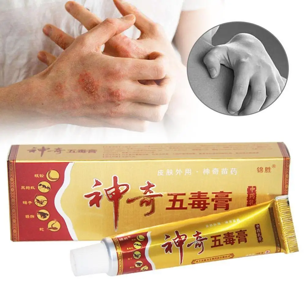 

Herbal Psoriasis Pruritus Cream Dermatitis Eczematoid Eczema Ointment Treatment Psoriasis Cream Skin Care Cream