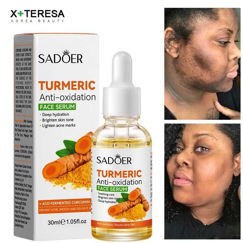 Turmeric Serum Facial Whitening Dark Spot Remover Acne Scar Bright Skin