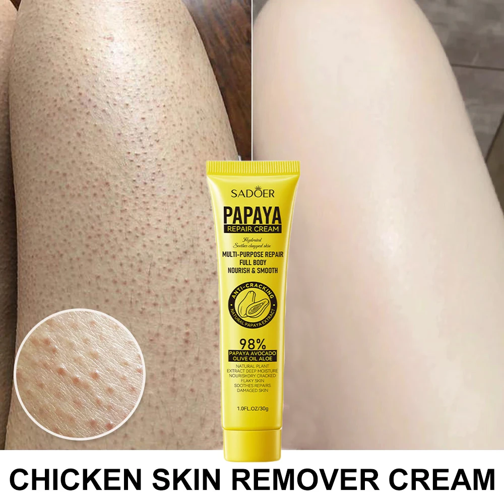 

Новый крем для восстановления куриной кожи лечение кератоза фолликул Pilaris удаление толстых пор темных точек увлажнение Гладкий уход за кожей