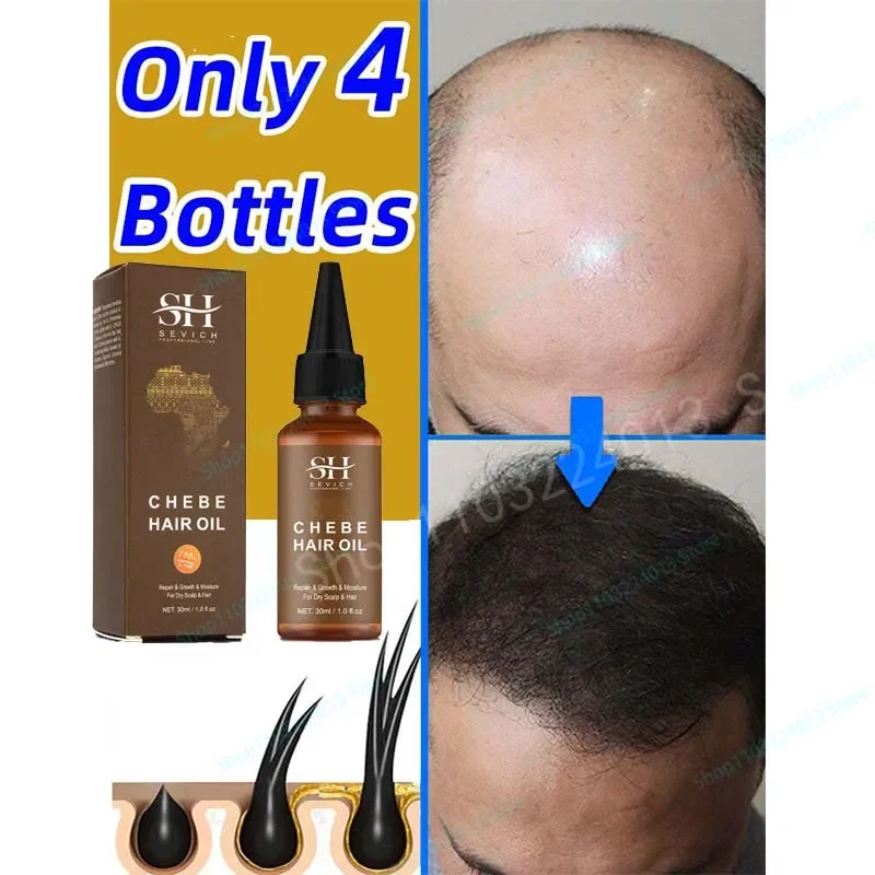 Chebe Traction Alopecia Thicken Oil Anti Hair Loss Treatment Spray Craze Fast Hair Growth Products Sevich Anti Break Hair Care