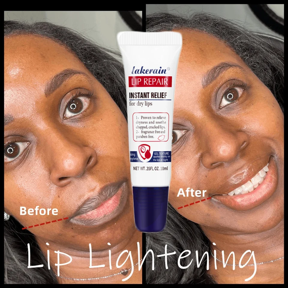 

Lip Black Removal Lip Balm Dull Fade Black Lip Exfoliating Product Moisturizing Nourish Brighten Repair Lip Lines Care Cosmetics