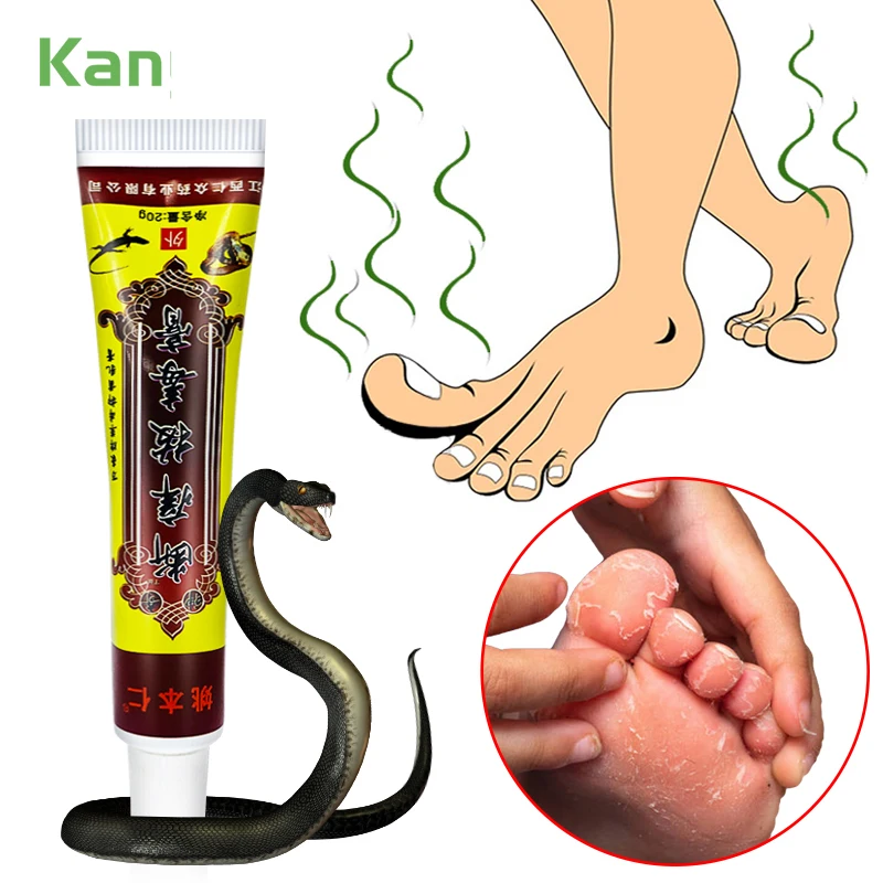

1pcs Anti-itch Fungal Skin Treatment Cream Foot Odor Itchy Feet Psoriasis Tinea Cruris Athlete's Foot Jock Itch Pityriasis S009