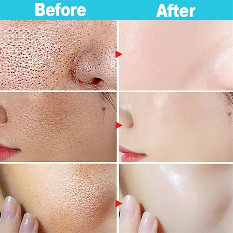 Salicylic Acid Pore Shrinking Face Cream Large Pores Tightening Repairing Serum Moisturizing Oil Control Skincare Women Makeup