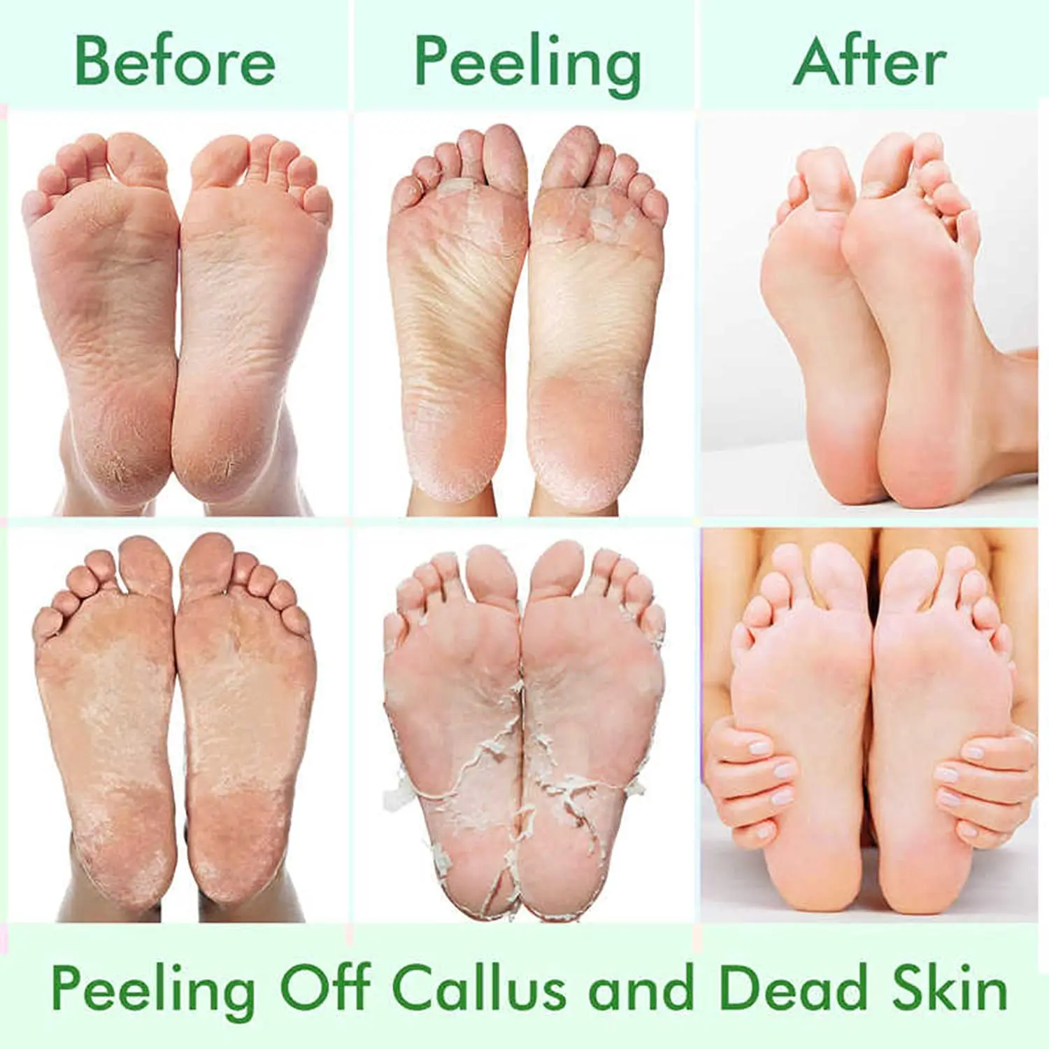 Foot Peel Mask Foot Peel Mask Exfoliator Callus Remover For Dry Cracked Feet With Lavende