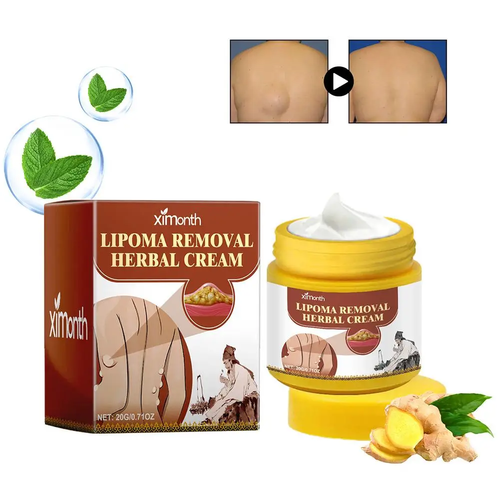1pc Lipoma Removal Herbal Cream Body Cream Dissolving Fat Easy To Use Herbal Lipoma Removal Cream