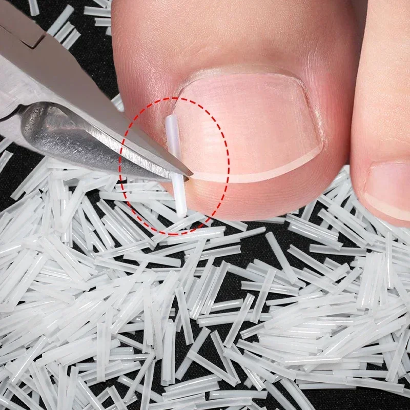 100PCS Ingrown Toenail Correction Ultra-thin Nail Treatment Elastic Patch Sticker Straightening Nails Groove Ingrown Corrector