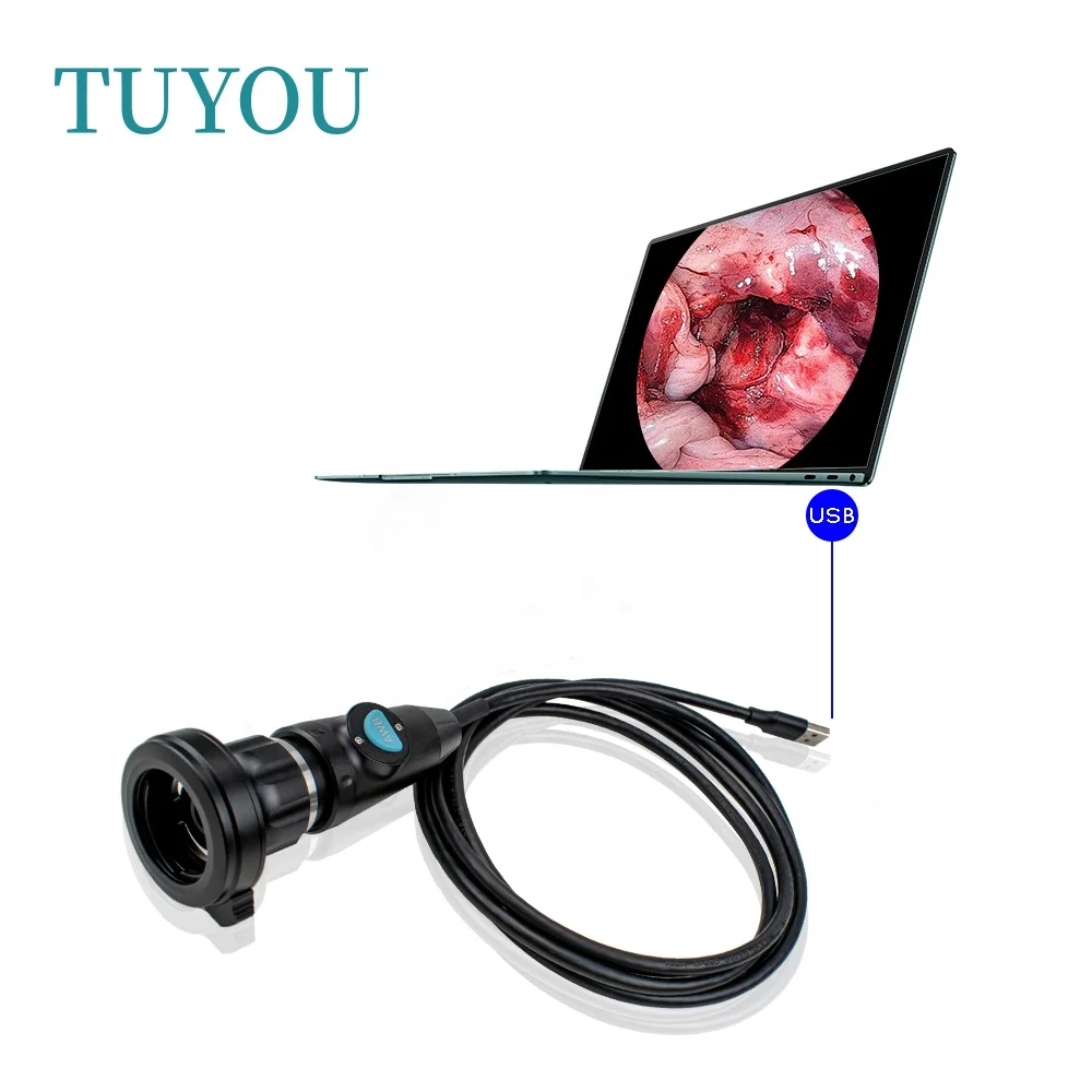 

Portable USB Endoscope with Medical Optic Coupler for ENT Nasal Otoscope