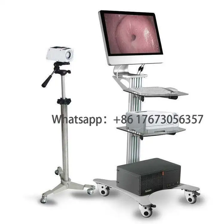 

Оборудование для гинекологии для нанесения шейного видео Colposcopy Culposcope hine