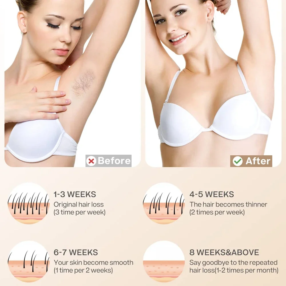 Mijia IPL Permanent Lady Laser Hair Remover Device Ice Cool Painless Epilator For Women Body Bikini Facial Hairs_voghion.com