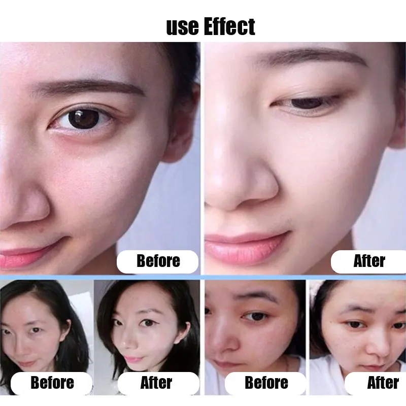 Hair Vitamin Capsule Hair Treatment 10Pcs Capsules Vitamin E Capsules For Face Hair Skin Whitening Essence Freckle Brighten Repair Ance Scar Hydrating Face Serum
