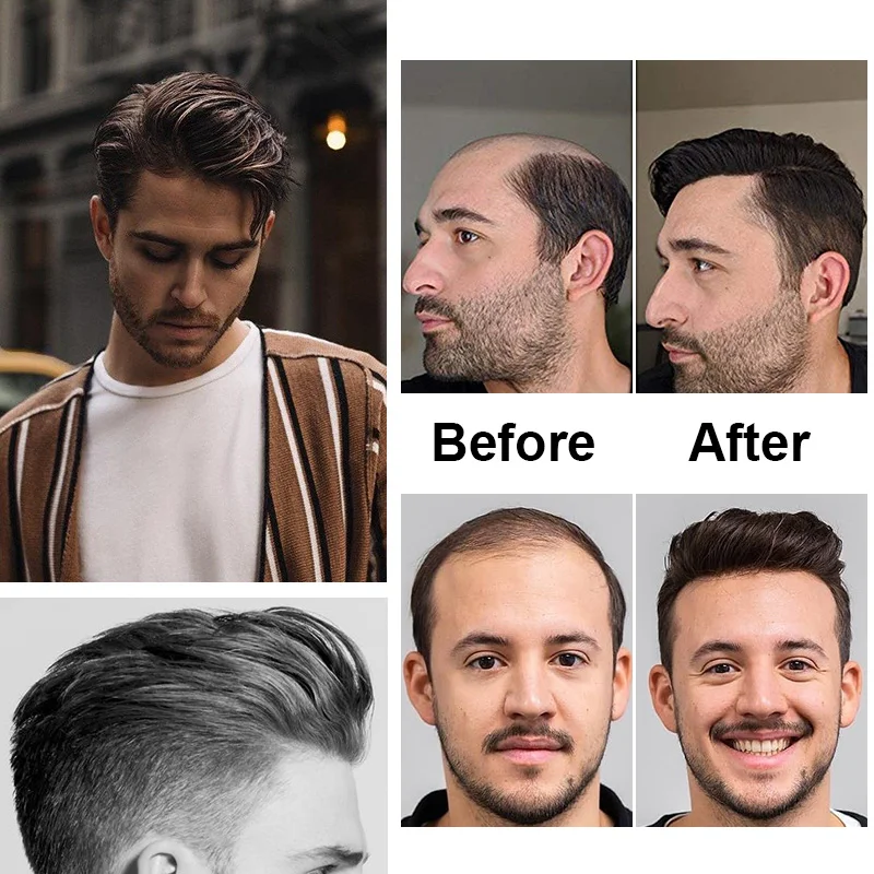 Male Wig Men Capillary Prothesis Machine Made Wig Natural Hairpiece 100% Human Hair Replacement System Natural Black Men Toupee