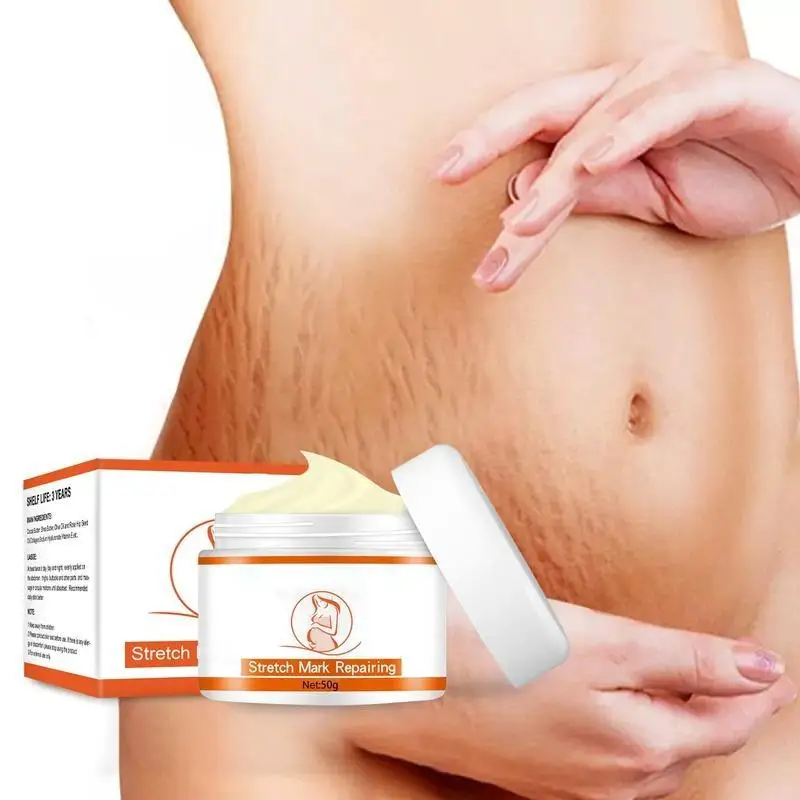 Repair cream For pregnant women tightening loose skin care growth lines postpartum care to improve faded lines skin cream
