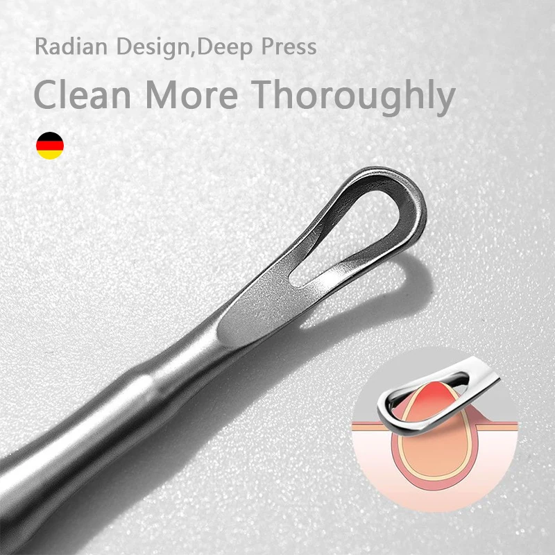New German Acne Blackhead Removal Needles Pimples Blackhead Clip Tweezers Beauty Artifact Blemish Extractor Remover Needle Tool 2