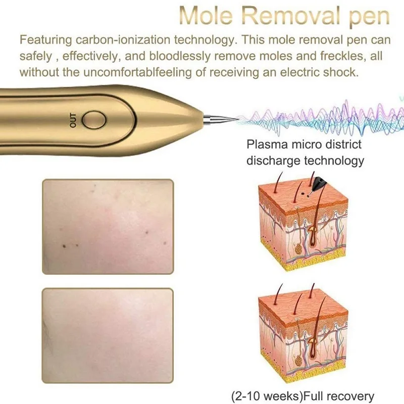 PAKISS LCD Plasma Pen LED Lighting Laser Tattoo Mole Removal Machine Face Care Skin Tag Remover Freckle Wart Dark Spot FY-104
