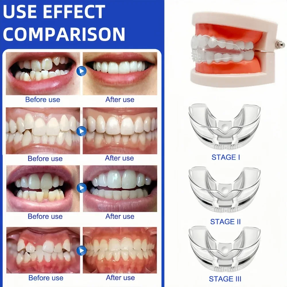 Adults Kids Three Stages Silicone Tooth Invisible Orthodontic Set Dental Appliance Teeth Retainer Mouth Guard Braces Tooth Tray 3