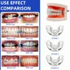 Adults Kids Three Stages Silicone Tooth Invisible Orthodontic Set Dental Appliance Teeth Retainer Mouth Guard Braces Tooth Tray 3