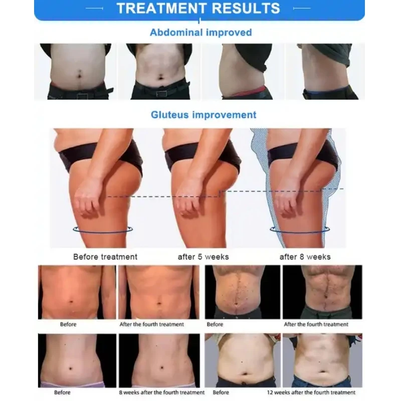 Рисунок 5 - Машина для Похудения Ems 2023 потеря