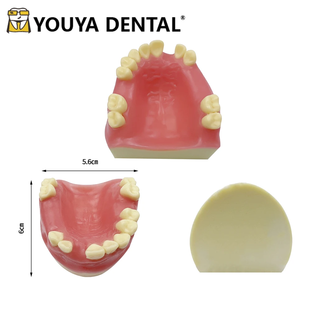 

Implant Teaching Model Of Maxillary Missing Teeth for Dental Technician Training Studying Doctor-patient Communication Tool
