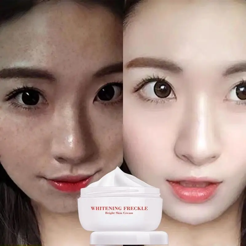 Bright Skin Cream Powerful Whitening Freckle Cream Remove Melasma Acne Spots Pigment Melanin Dark Spots Face Care Cream skin