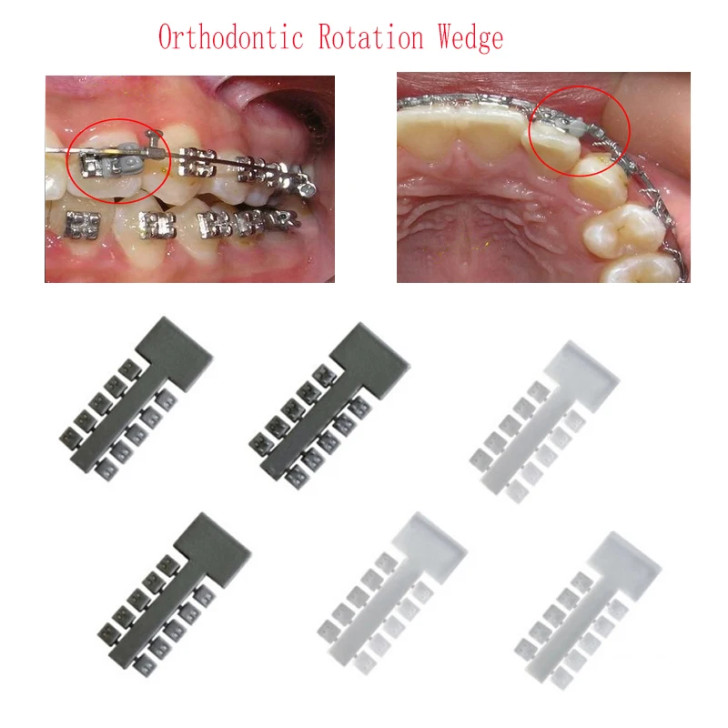 200pcsLotHighElasticOrthodonticRotationWedgesHighStrength