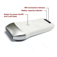 Competitive Price Handheld Pocket Ultrasound Portable Wireless Ultrasound Scanner Working With IOS/Android/Windows 2
