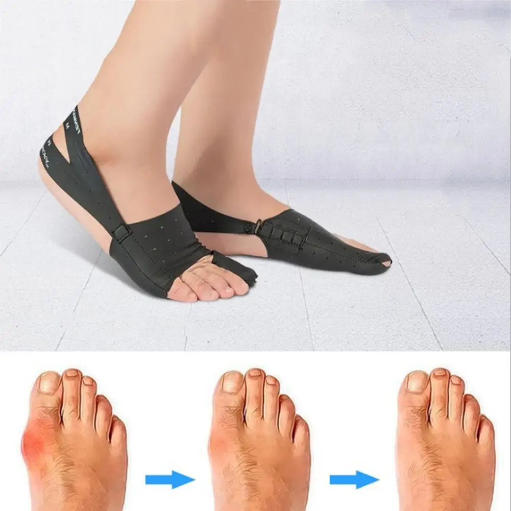 

Sdotter 1pc Bunion Corrector Toe Separator Corrector Pain Relieve Toe Corrector Hallux Valgus Foot Care Pedicure Orthotics Hallu