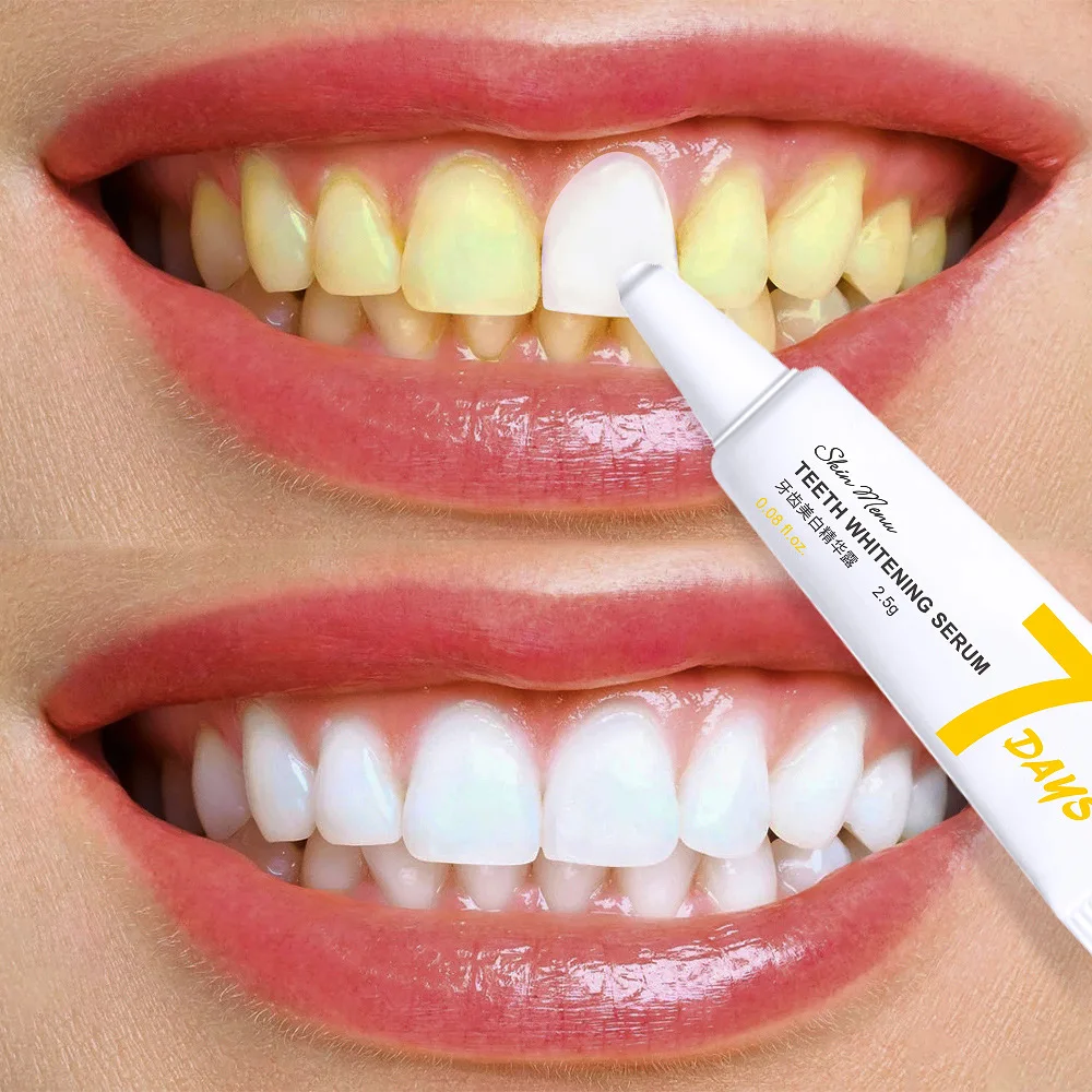 Teeth Whitening Essence Clean Oral Hygiene Whiten Teeth Remove Plaque Stains Fresh Breath Oral Hygiene Oral care Dental care set lanbena oral care teeth whitening pen dental whitener lemon lime hygiene gel effective remove stains cleaning tooth white tools