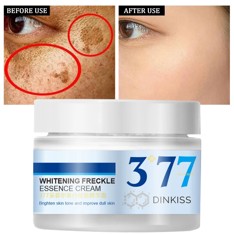 Whitening Freckle Essence Face Cream Moisturizes Brightening Removes Dark Spots Chloasma Pigmentation Anti Wrinkle Skin Care 50g 50ml clear and rejuvenated skin gently deep cleans pores and removes oil skin brightening sodium hyaluronate massage cream