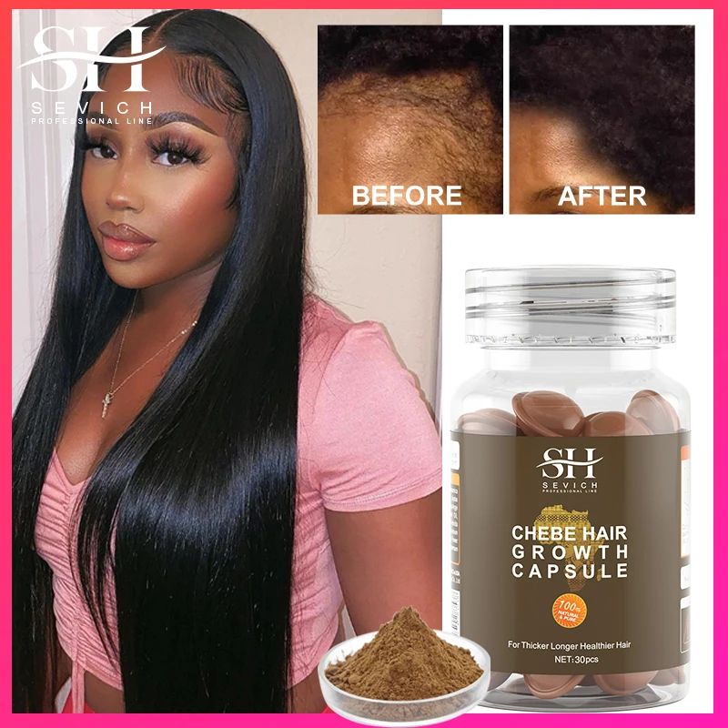 30PCS 2023 Fast Hair Growth Capsule African Crazy Traction Alopecia Chebe Anti Hair Break Hair Strengthener Hair Loss Treatment fast oil african crazy traction alopecia chebe hair mask anti hair break hair strengthener hair loss treatment spray