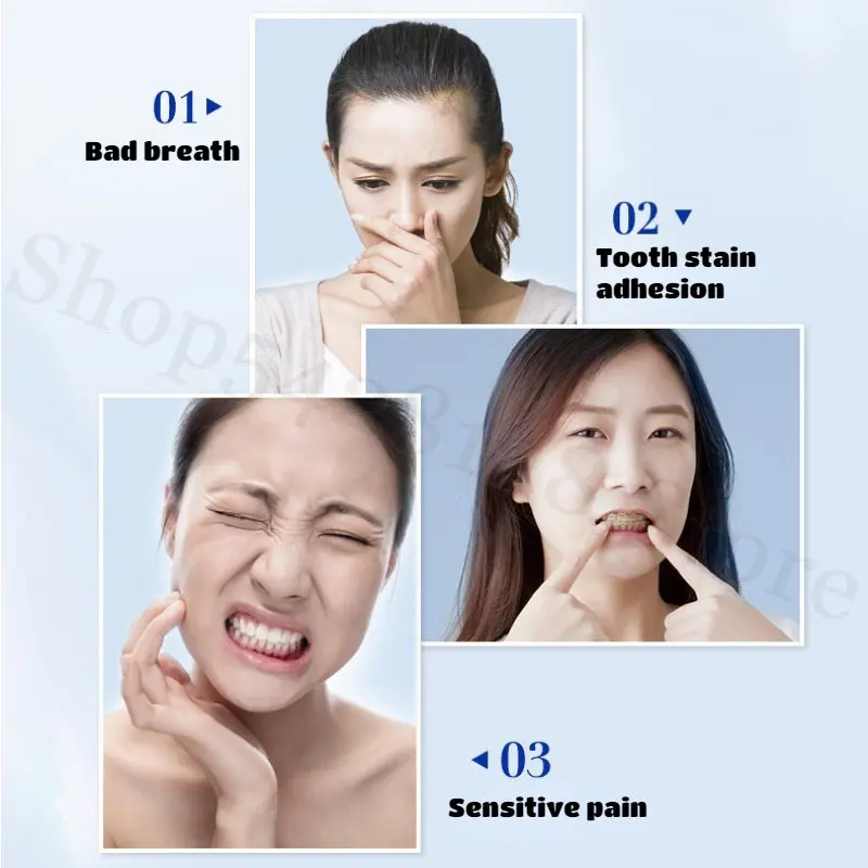 Bodyaid Probiotic Toothpaste Niacinamide Whitens and Refreshes Teeth Fresh and Cleans Oral Dirt To Reduce Tooth Wear 100g