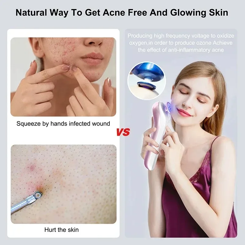 Facial Massager Plasma Facial Massager Blue Light Laser Ozone Treatment Device Scar Acne Removal Machine Anti Wrinkle Skin Care Beauty Device