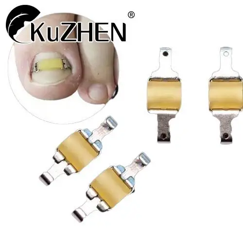 

Ingrown Toenail Corrector Tools Pedicure Professional Ingrown Toenail Correction Foot Care Tool Recover Embed Toenail Treatment