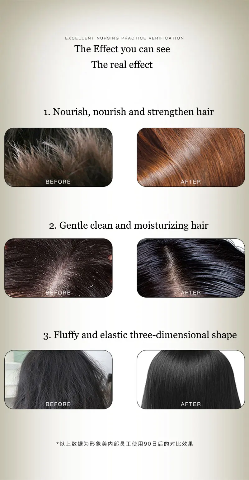 Chinese Formula Ginger Shampoo for Anti Hair Loss Fast Growth Hair Grow Thicker Dense Control Hair Oil Treatment Dandruff 300ml images - 6