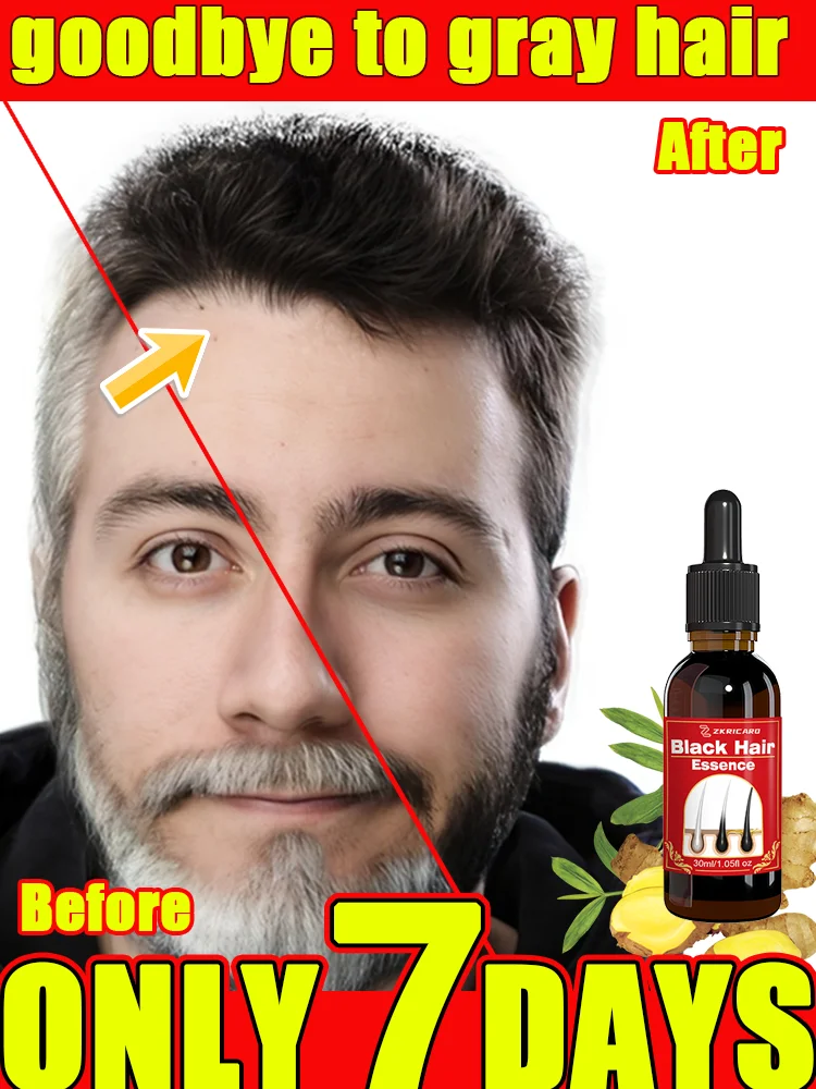 Hair Essence Oil Natural Anti-Grey Hair Restoration Prevention Root Repair